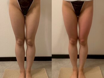 グランディール(GRANDIR)/【痩身】下半身コース2回