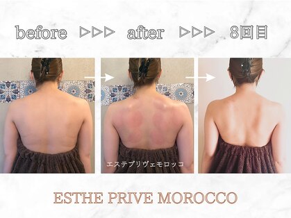 エステプリヴェモロッコ(ESTHE PRIVE MOROCCO)の写真