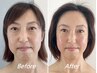 【40代からの本気たるみ改善】美骨形成術　歪み・リフトアップ施術◎根本改善
