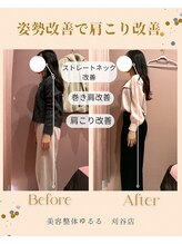 ユルル 刈谷店(Yururu)/変化(骨盤整体＆猫背整体)
