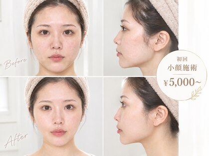 リフト 戸塚(Lift)の写真