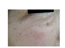 ウル(Ulu)/【小じわ改善！】