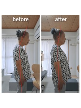 はらカイロプラクティックセンター/【施術例】ビフォーアフター