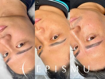 エピズム(EPISMU)