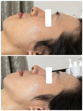 ビジュープラス 幸手店(Bijou+)/スタンダート（オプションなし）