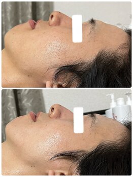 ビジュープラス 幸手店(Bijou+)/スタンダート（オプションなし）