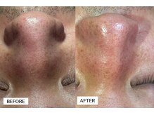 エングラッシー(en glassy)/BEFORE　AFTER　30代