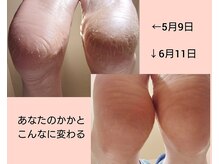 インプルーヴ(improve)の雰囲気（【尾張旭】SEIYU瀬戸店からすぐ♪停めやすい駐車場完備♪）