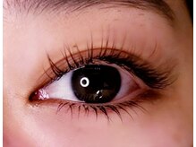 上下マツエクで中顔面短縮♪小顔効果