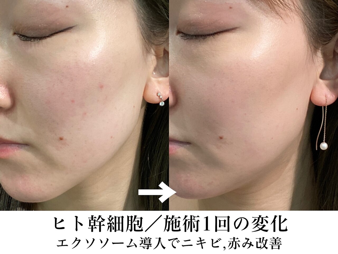 ビービーサロン 池袋(B.B salon)｜ホットペッパービューティー