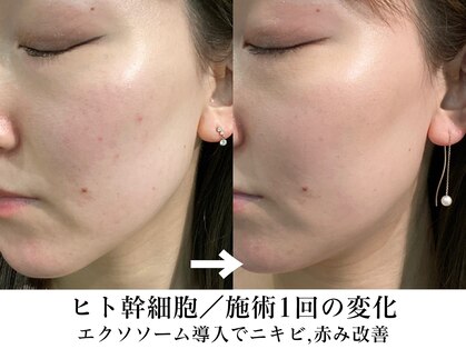 ビービーサロン 池袋(B.B salon)の写真