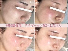 レクラ バイ ドクターエイチ(L'ECLAT by Doctor.H)の雰囲気（毛穴レス水光肌☆☆鏡を見るのが楽しみになる肌へ導きます♪）