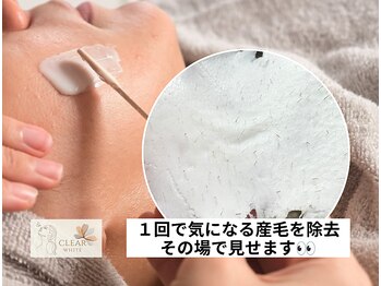 クリアホワイト(Clear White)/人気のワックス脱毛