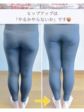 ポノフィット(PONO FIT.)&nbsp;症例 美尻コース