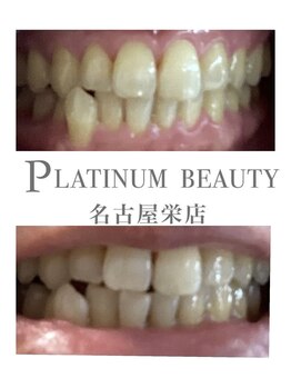 プラチナムビューティー 名古屋栄本店(PLATINUM BEAUTY)/お客様Before After