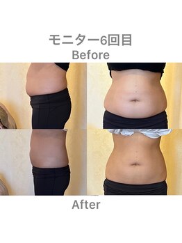 ルタン リッシュ(Le temps Riche)/フィットカービング