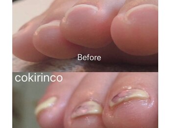 コキリンコ 葉山(cokirinco)/