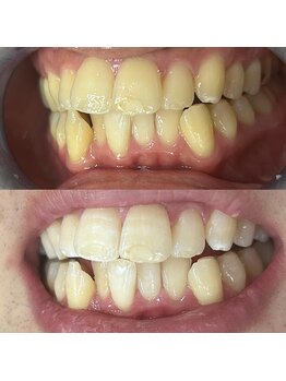 ライトビューティー 池袋店(LightBeauty)/症例写真