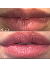 リュミエール デスポワール(Lumiere d'espoir)/ローマピンク