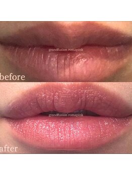 リュミエール デスポワール(Lumiere d'espoir)/ローマピンク