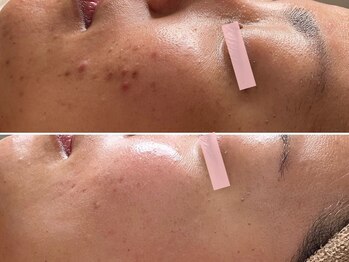 エイプリルフールズ(April fools)/【30代後半】凹凸が滑らかに！！