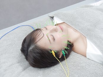 ハリカ 大阪梅田店(HARIKA)/たるみ/むくみの解消に美容鍼