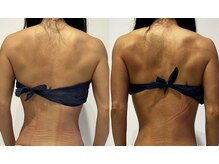 ビューティーサロン セガール(segar)/カット出し