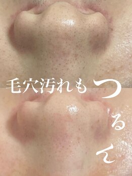 ピウ(piu)/【毛穴汚れ】ハーバルピーリング