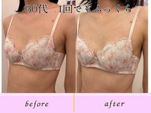 ビーハピネス 京都西院(B-Happiness)/30代　デコルテからふっくら