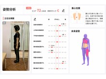 エイド鍼灸整骨院 宮前平院の雰囲気（AI姿勢分析でお身体の状態を客観的に検査します！）