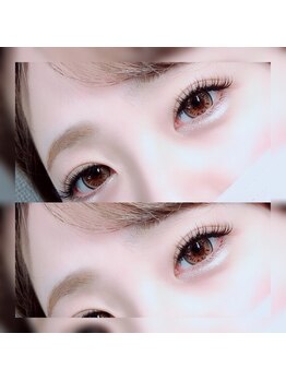 フロラ(Flora)/◇フラットマットラッシュ