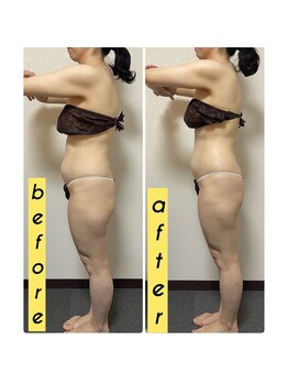 コクーン(COCOON)/痩身