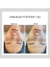 ポムハヌル(pom.haneul)/韓国肌管理室