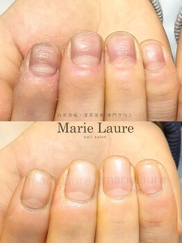 マリーロール 淀屋橋本店(Marie Laure)/自爪育成/深爪矯正/ネイルケア