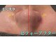 クリーンビューティーメディカルサロン(CLEAN BEAUTY Medical Salon)の写真