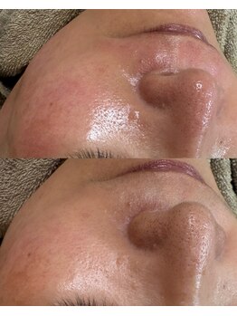 モンクラッシー(Mon classy)/潤艶ワックスとハーブピーリング