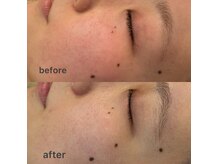 ビューベス(Beauves)