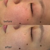 ビューベス(Beauves)