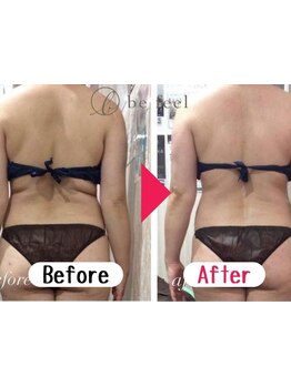 太モモ・ヒップまわりをケアしたい