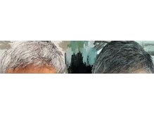 スグァン(sugwang)/理学療法機器P90