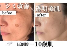 パールホワイトニングサロン 大船店