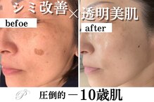 パールホワイトニングサロン 大船店