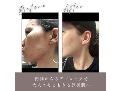 ヨサパーク グリーン 多摩センター店(Yosa Park green)の写真