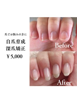 ヴィオテラス(VIOTERRACE)の写真/自爪育成や深爪矯正で爪を綺麗にケア!理想の縦長な美爪づくりを応援◎