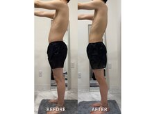 ナルシス/【痩身】4回の変化★