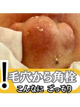 ビビ(VIVI)/毛穴ケアにララピーリング