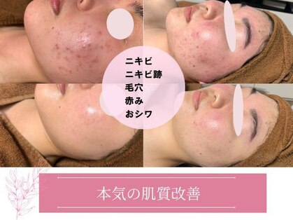プレジール(plasir)の写真