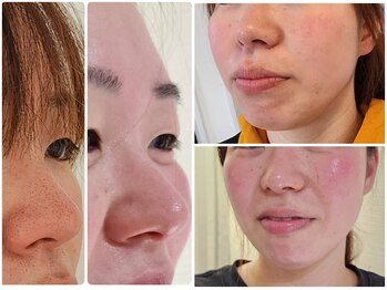 トミーズネイル(tommy's nail)