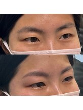 ブリス 姫路(Bliss)/お客様Before/After