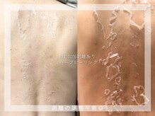 エト(eto.)の雰囲気(剥離の調整可能◎ハーブピーリング|肌質改善ハーブピーリング)